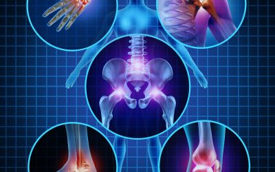 Improve Daily Life With Help From a Lower Back Pain Chiropractor in Highlands Ranch, CO