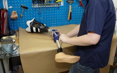 Advantages of Using Callipers For Legs in Daily Mobility for Indian Patients